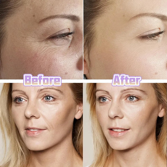 Facial Lifting Tapes – Instant Face Lift 40pieces